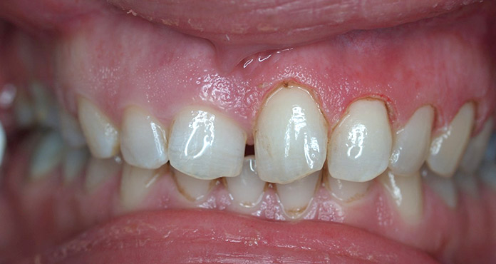 نمونه کار کلینیک دندانپزشکی کاخ