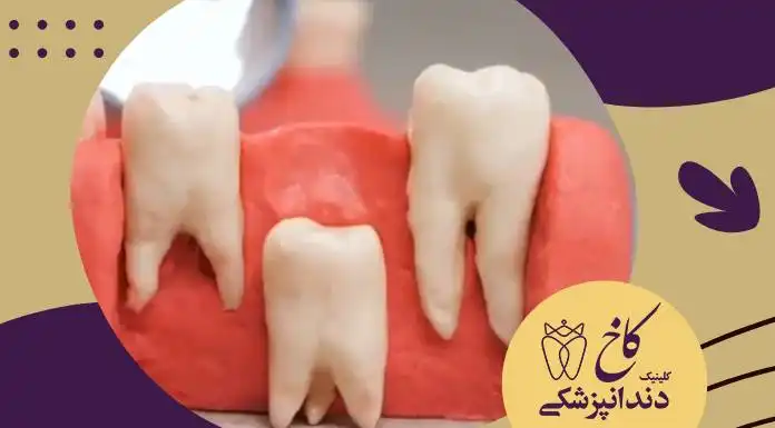 دانستنی های دندان شیری کودکان